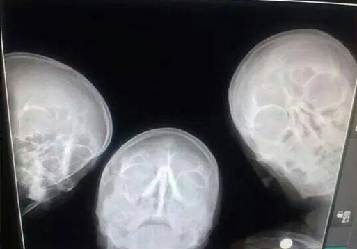 selfie_of_radiologists.png