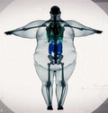 x-ray-fat-man