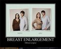 breast-enlargement-without-surgery